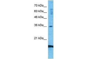 Host:  Rabbit  Target Name:  CCL18  Sample Type:  Fetal Lung lysates  Antibody Dilution:  1. (CCL18 Antikörper  (Middle Region))
