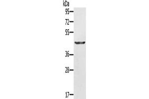 Gel: 10 % SDS-PAGE, Lysate: 30 μg, Lane: A549 cells, Primary antibody: ABIN7130044(KRT31 Antibody) at dilution 1/500, Secondary antibody: Goat anti rabbit IgG at 1/8000 dilution, Exposure time: 10 seconds (Keratin 31 Antikörper)
