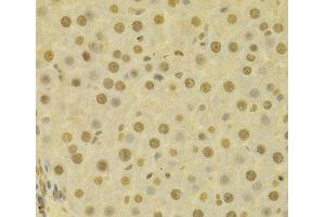 Immunohistochemistry of paraffin-embedded Human liver using COPS5 Polyclonal Antibody at dilution of 1:100 (40x lens). (COPS5 Antikörper)
