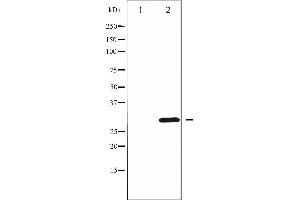 Western blot analysis of Cyclin D3 phosphorylation expression in UV treated K562 whole cell lysates,The lane on the left is treated with the antigen-specific peptide.