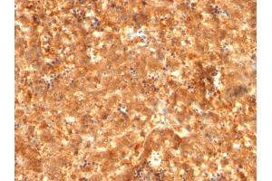 Formalin-fixed, paraffin-embedded human Fetal Liver stained with AFP Mouse Monoclonal Antibody (C2 + C3 + MBS-12). (alpha Fetoprotein Antikörper)