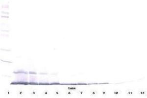 Image no. 1 for anti-Chemokine (C-C Motif) Ligand 22 (CCL22) antibody (ABIN464842) (CCL22 Antikörper)