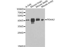 Western blot analysis of extracts of various cell lines, using PDHA2 antibody. (PDHA2 Antikörper  (AA 119-388))