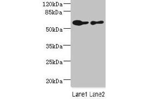 Western blot All lanes: CHRNA6 antibody at 2. (CHRNA6 Antikörper  (AA 26-239))