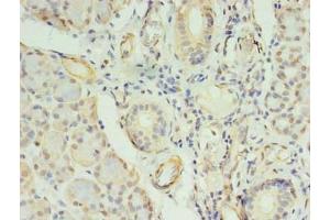Immunohistochemistry of paraffin-embedded human pancreatic tissue using ABIN7148009 at dilution of 1:100 (COPB1 Antikörper  (AA 2-200))