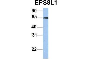 Host:  Rabbit  Target Name:  EPS8L1  Sample Type:  Jurkat  Antibody Dilution:  1. (EPS8-Like 1 Antikörper  (Middle Region))