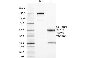 SDS-PAGE Analysis Purified CEA Mouse Monoclonal Antibody (C66/1009). (CEACAM5 Antikörper)