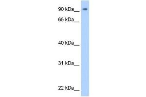 WB Suggested Anti-ZNF408 Antibody Titration:  0. (ZNF408 Antikörper  (N-Term))