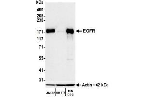 Western Blotting (WB) image for anti-Epidermal Growth Factor Receptor (EGFR) (C-Term) antibody (ABIN7795642) (Rekombinanter EGFR Antikörper  (C-Term))