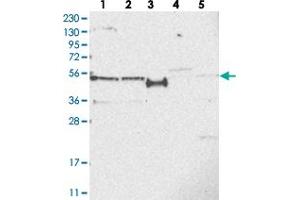 Western blot analysis of Lane 1: RT-4, Lane 2: U-251 MG, Lane 3: Human Plasma, Lane 4: Liver, Lane 5: Tonsil with SLCO4A1 polyclonal antibody .