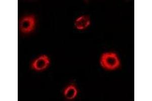 Immunofluorescent analysis of eIF4A1 staining in MCF7 cells. (EIF4A1 Antikörper)