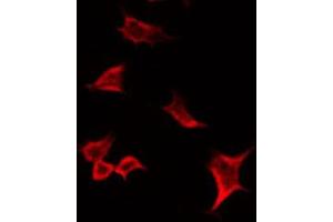 ABIN6266594 staining HuvEc by IF/ICC. (MMP19 Antikörper  (N-Term))
