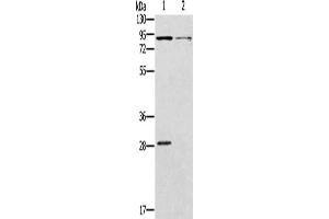 Gel: 8 % SDS-PAGE, Lysate: 40 μg, Lane 1-2: Mouse kidney tissue, Mouse brain tissue, Primary antibody: ABIN7128983(CNGA3 Antibody) at dilution 1/500, Secondary antibody: Goat anti rabbit IgG at 1/8000 dilution, Exposure time: 2 minutes