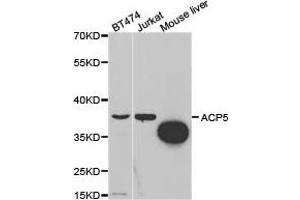 Western Blotting (WB) image for anti-Acid Phosphatase 5, Tartrate Resistant (ACP5) antibody (ABIN1870772) (ACP5 Antikörper)