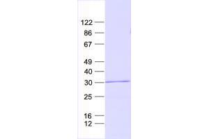 Western Blotting (WB) image for Caspase Recruitment Domain Family, Member 16 (CARD16) protein (His tag) (ABIN2713162)
