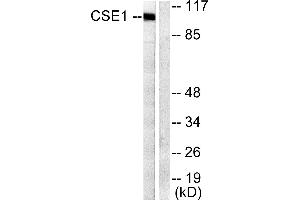 Western blot analysis of extracts from 293 cells, using CSantibody. (Exportin 2 Antikörper)