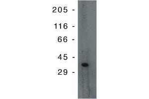 Western Blotting (WB) image for anti-Tumor Protein P53 Inducible Protein 3 (TP53I3) antibody (ABIN264400) (TP53I3 Antikörper)
