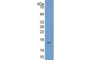 Mouse Capture antibody from the kit in WB with Positive Control: Human Serum. (TTR CLIA Kit)