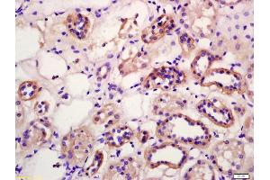 Immunohistochemistry (IHC) image for anti-Wingless-Type MMTV Integration Site Family, Member 10B (WNT10B) (AA 201-300) antibody (ABIN702295)