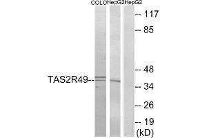 Western blot analysis of extracts from COLO cells and HepG2 cells, using TAS2R49 antibody. (TAS2R20 Antikörper  (Internal Region))