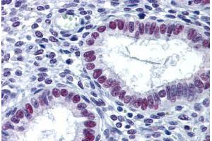 Human Uterus: Formalin-Fixed, Paraffin-Embedded (FFPE) (LSD1 Antikörper  (AA 753-852))