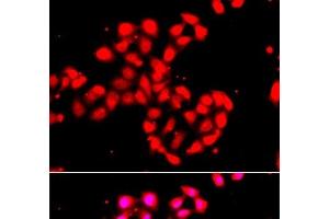 Immunofluorescence analysis of A549 cells using CAMK1D Polyclonal Antibody (CAMK1D Antikörper)