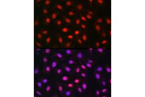 Immunofluorescence analysis of U-2 OS cells using MDC1 Rabbit pAb (ABIN6134688, ABIN6143659, ABIN6143661 and ABIN6216452) at dilution of 1:150 (40x lens). (MDC1 Antikörper  (AA 1-100))