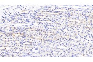 Detection of SLC in Rat Stomach Tissue using Polyclonal Antibody to Secondary Lymphoid Tissue Chemokine (SLC) (CCL21 Antikörper  (AA 5-132))