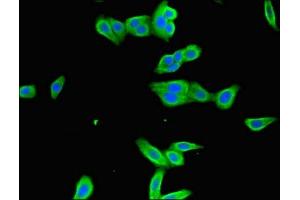 Immunofluorescent analysis of HepG2 cells using ABIN7156533 at dilution of 1:100 and Alexa Fluor 488-congugated AffiniPure Goat Anti-Rabbit IgG(H+L) (ICAM1 Antikörper  (AA 320-480))