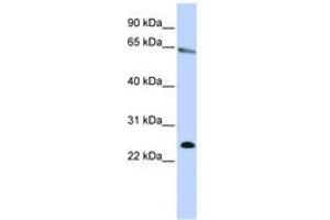 Image no. 1 for anti-Zinc Finger Protein 326 (ZNF326) (N-Term) antibody (ABIN6740648) (ZNF326 Antikörper  (N-Term))