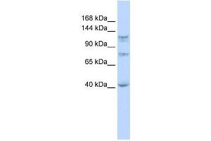 DHX30 antibody used at 1 ug/ml to detect target protein. (DHX30 Antikörper)