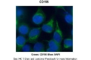 Researcher: Dr. (Poliovirus Receptor Antikörper  (N-Term))