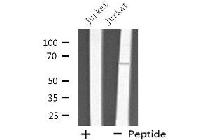 Western blot analysis of extracts from Jurkat cells, using THAS antibody.