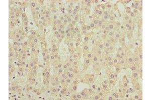 Immunohistochemistry of paraffin-embedded human adrenal gland tissue using ABIN7148308 at dilution of 1:100 (COMMD2 Antikörper  (AA 5-199))