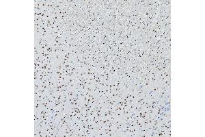 IHC analysis of SNRNP200 using anti-SNRNP200 antibody (ABIN7602032). (SNRNP200 Antikörper  (AA 557-2129))