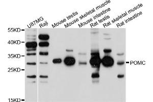 Western blot analysis of extracts of various cell lines, using POMC antibody (ABIN5971555) at 1/1000 dilution. (ACTH Antikörper)