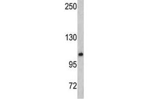 Western blot analysis of OGT antibody and mouse bladder tissue lysate (OGT Antikörper  (AA 1017-1046))