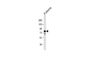 Anti-VTN Antibody (N-term) at 1:32000 dilution + human plasma lysate Lysates/proteins at 20 μg per lane. (Vitronectin Antikörper  (N-Term))