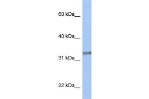 Human MCF-7; WB Suggested Anti-ACBD4 Antibody Titration: 0. (ACBD4 Antikörper  (N-Term))