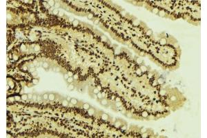 ABIN6277787 at 1/100 staining Mouse colon tissue by IHC-P. (SMARCA4 Antikörper  (N-Term))