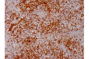 Immunohistochemistry (IHC) image for anti-Annexin A1 (ANXA1) antibody (ABIN6939608)