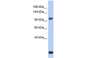 WB Suggested Anti-ATXN7 Antibody Titration: 0. (ATXN7 Antikörper  (Middle Region))