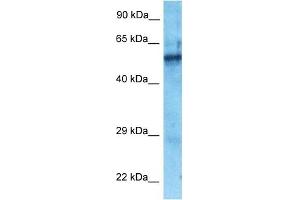 Host:  Rabbit  Target Name:  ZNF25  Sample Type:  Fetal Lung lysates  Antibody Dilution:  1. (ZNF25 Antikörper  (N-Term))