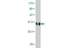 Western Blot detection against Immunogen (43. (LMO4 Antikörper  (AA 1-165))