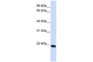 Claudin 19 antibody used at 1 ug/ml to detect target protein. (Claudin 19 Antikörper  (C-Term))