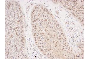 anti-RAD50 Homolog (S. Cerevisiae) (RAD50) (AA 700-750) antibody