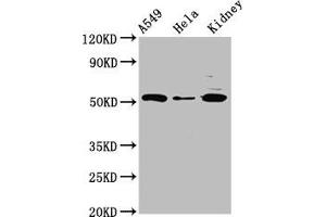 Western Blot Positive WB detected in: A549 whole cell lysate, Hela whole cell lysate, Rat kidney tissue All lanes: FICD antibody at 3 μg/mL Secondary Goat polyclonal to rabbit IgG at 1/50000 dilution Predicted band size: 52 kDa Observed band size: 52 kDa (FICD Antikörper  (AA 63-185))