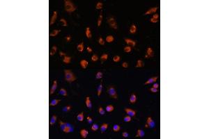Immunofluorescence analysis of L929 cells using TMEM25 antibody (ABIN7270963) at dilution of 1:100. (TMEM25 Antikörper  (AA 223-322))