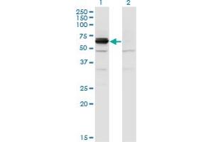 Western Blot analysis of DPYSL4 expression in transfected 293T cell line by DPYSL4 monoclonal antibody (M01), clone 1F5. (DPYSL4 Antikörper  (AA 461-559))