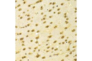 Immunohistochemistry of paraffin-embedded rat brain using HDGF Antibody (ABIN1876535) at dilution of 1:100 (40x lens). (HDGF Antikörper)